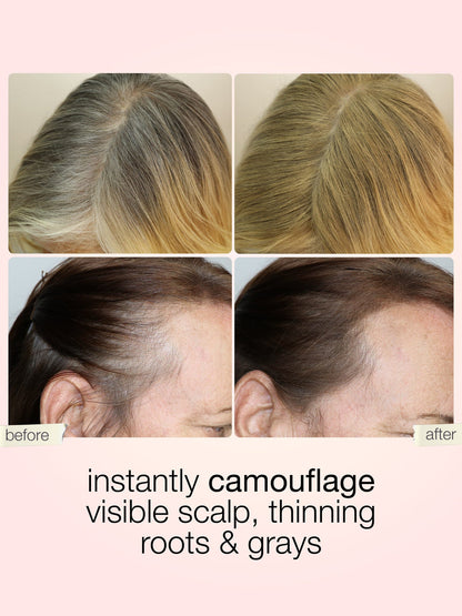Instant Hairline Eraser-Say Goodbye to Thinning Hair & Gray Roots in 5 Seconds flat.