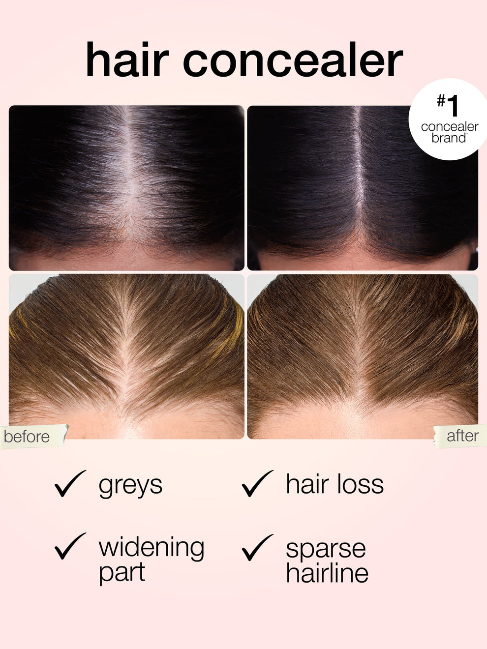 Instant Hairline Eraser-Say Goodbye to Thinning Hair & Gray Roots in 5 Seconds flat.