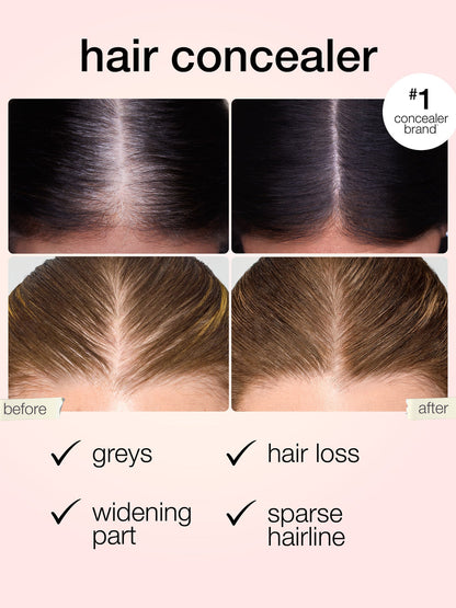 Instant Hairline Eraser-Say Goodbye to Thinning Hair & Gray Roots in 5 Seconds flat.